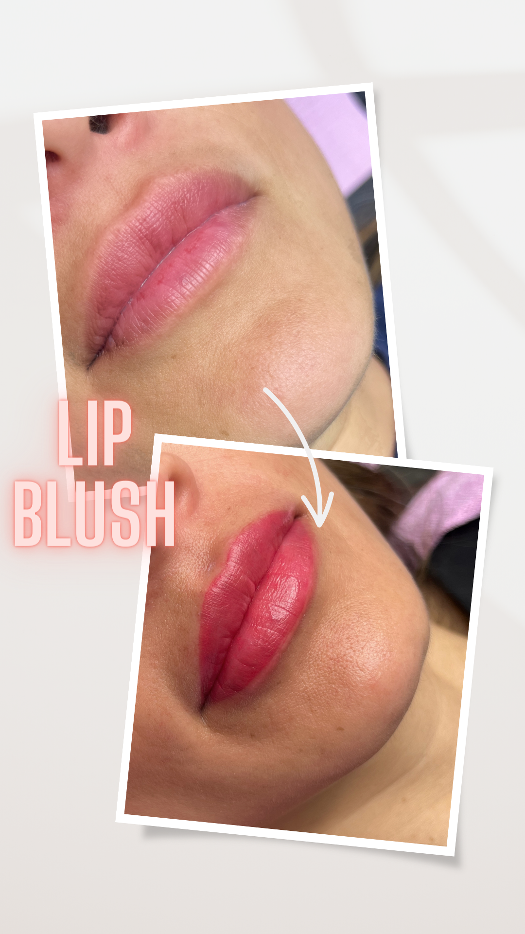 Lip Blushing