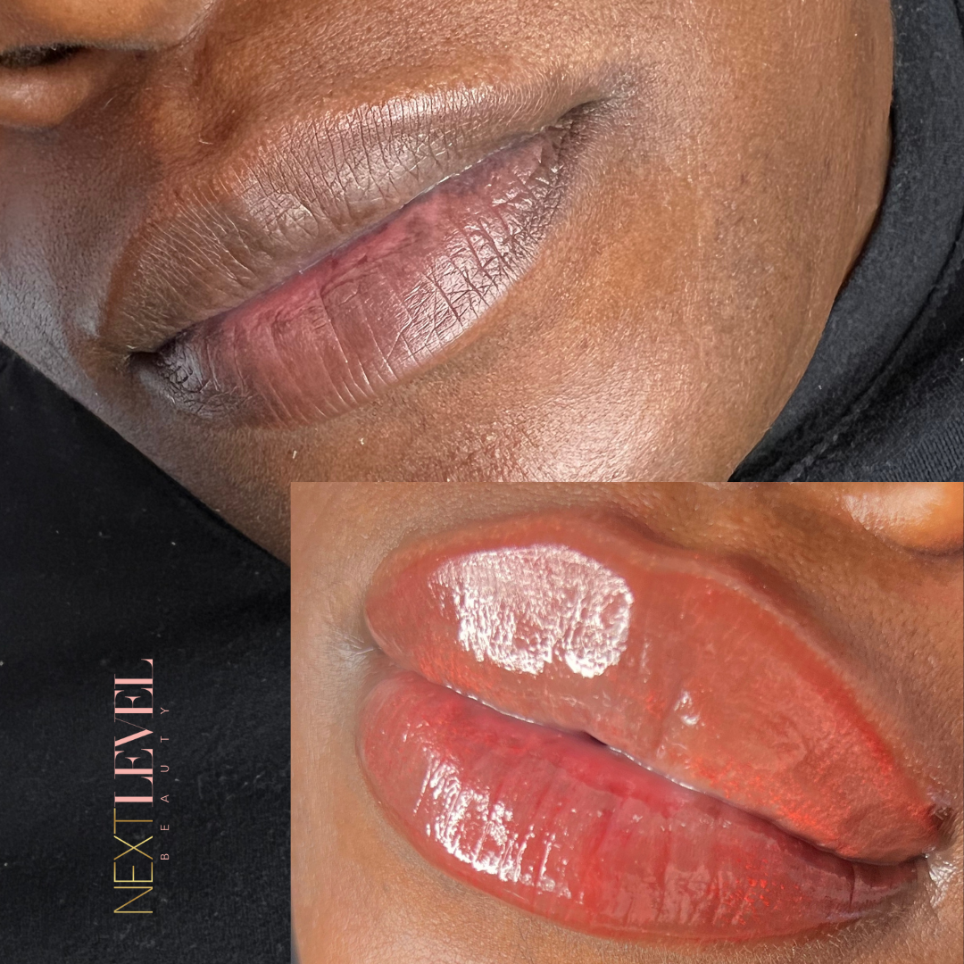 Lip Neutralization